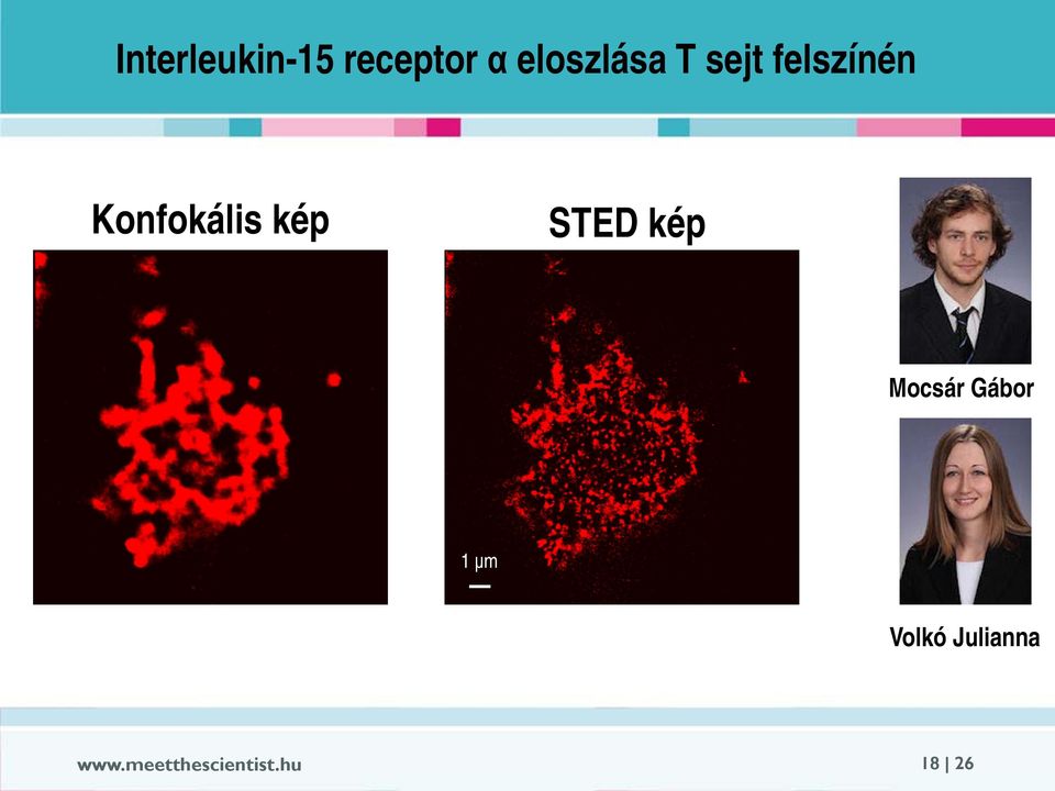 Konfokális kép STED kép Mocsár