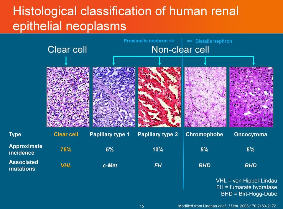 Oncocytoma Approximate incidence Associated mutations 75% 5% 10% 5% 5% VHL c-met FH BHD BHD VHL = von