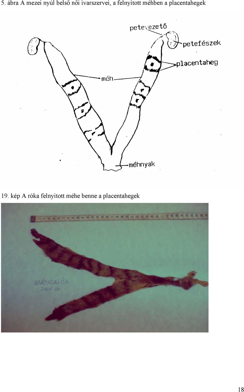 a placentahegek 19.