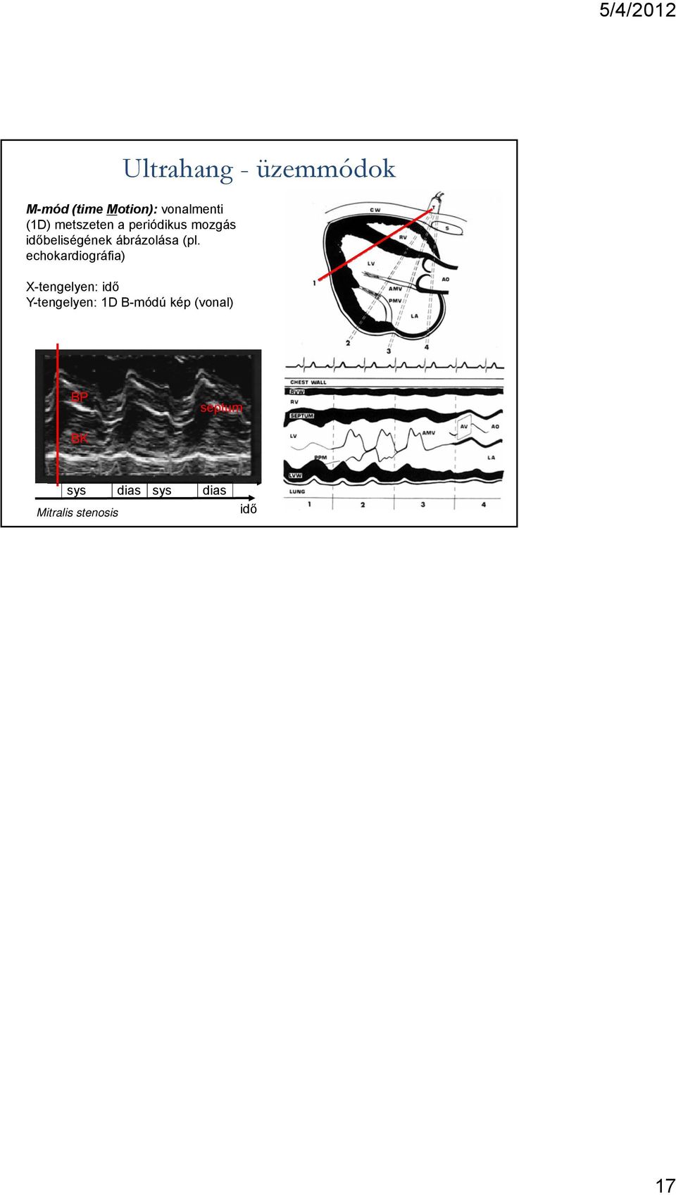 echokardiográfia) X-tengelyen: idő Y-tengelyen: 1D B-módú kép