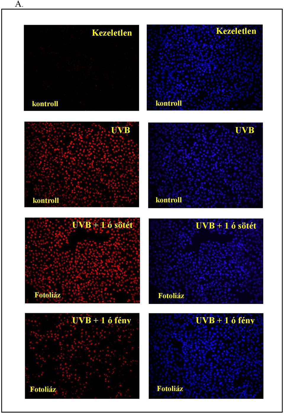 1 ó sötét UVB + 1 ó sötét Fotoliáz