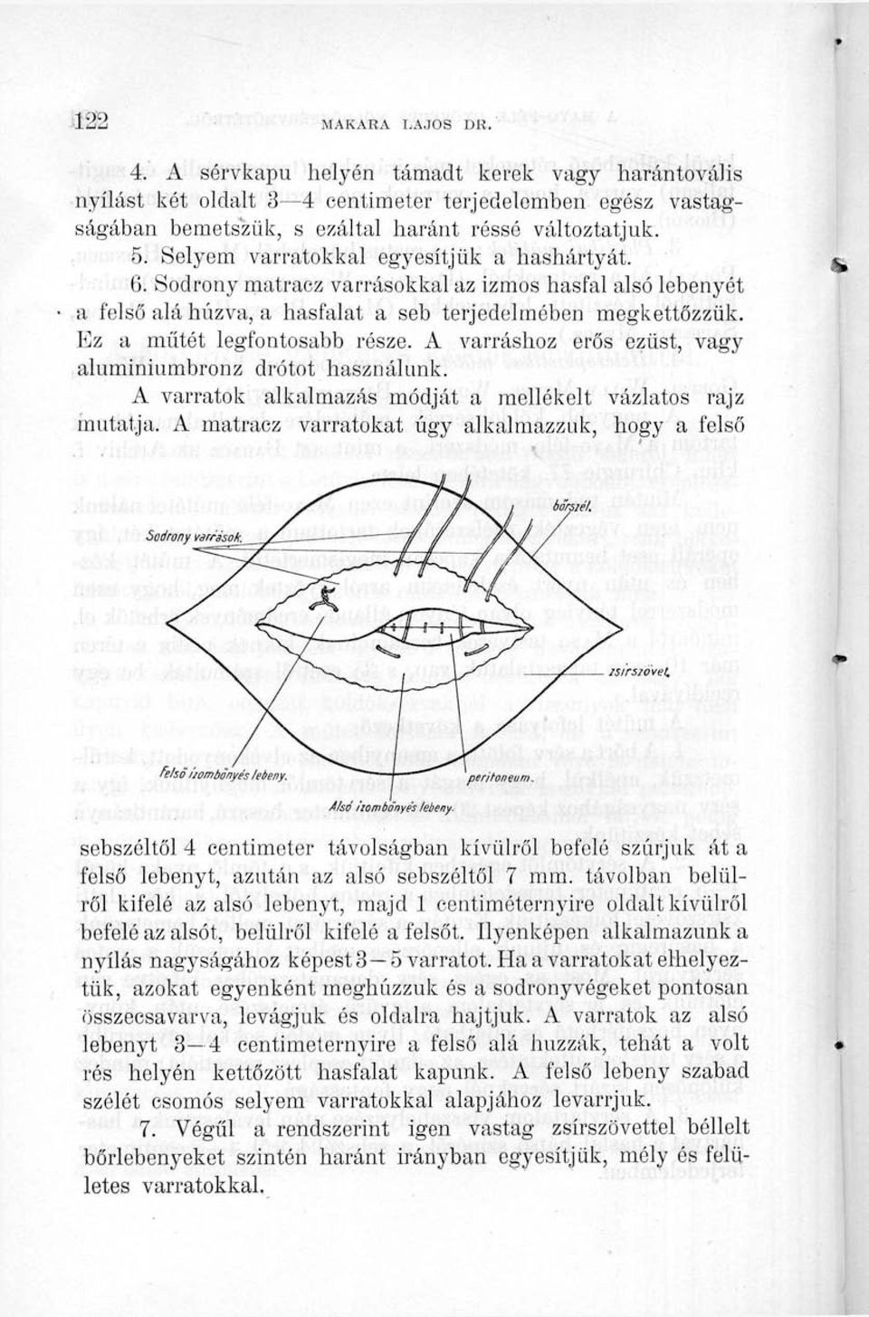 A varráshoz erős ezüst, vagy aluminiumbronz drótot használunk. A varratok alkalmazás módját a mellékelt vázlatos rajz mutatja. A matracz varratokat úgy alkalmazzuk, hogy a felső Sodrony varrások.