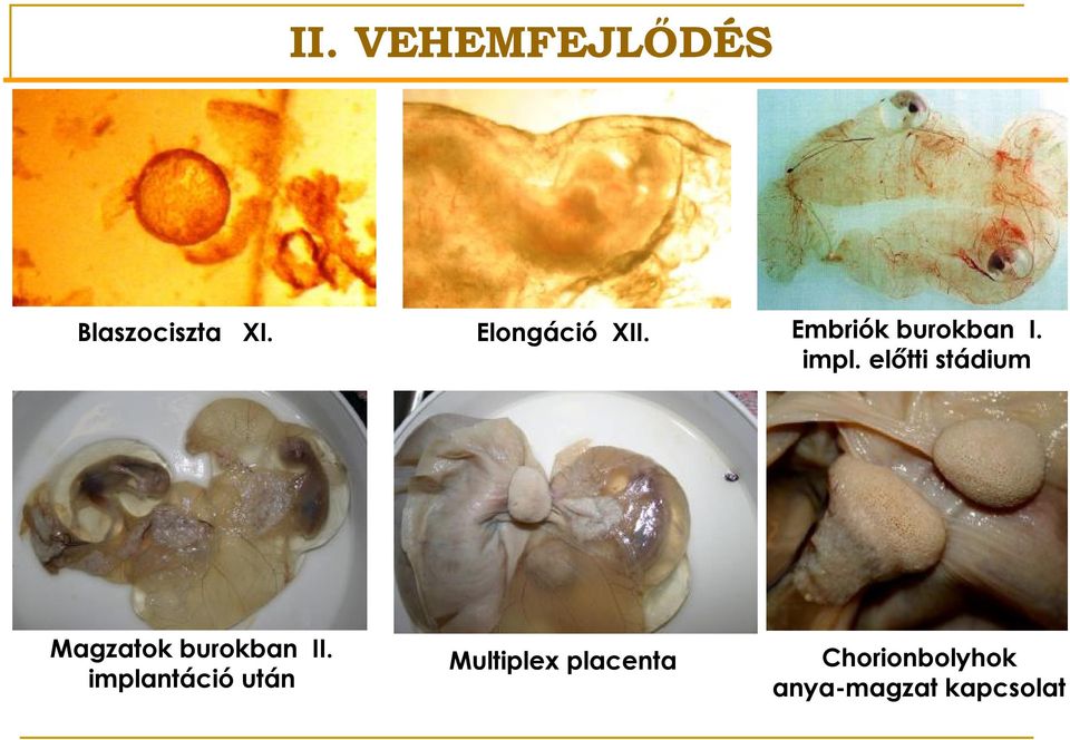 előtti stádium Magzatok burokban II.