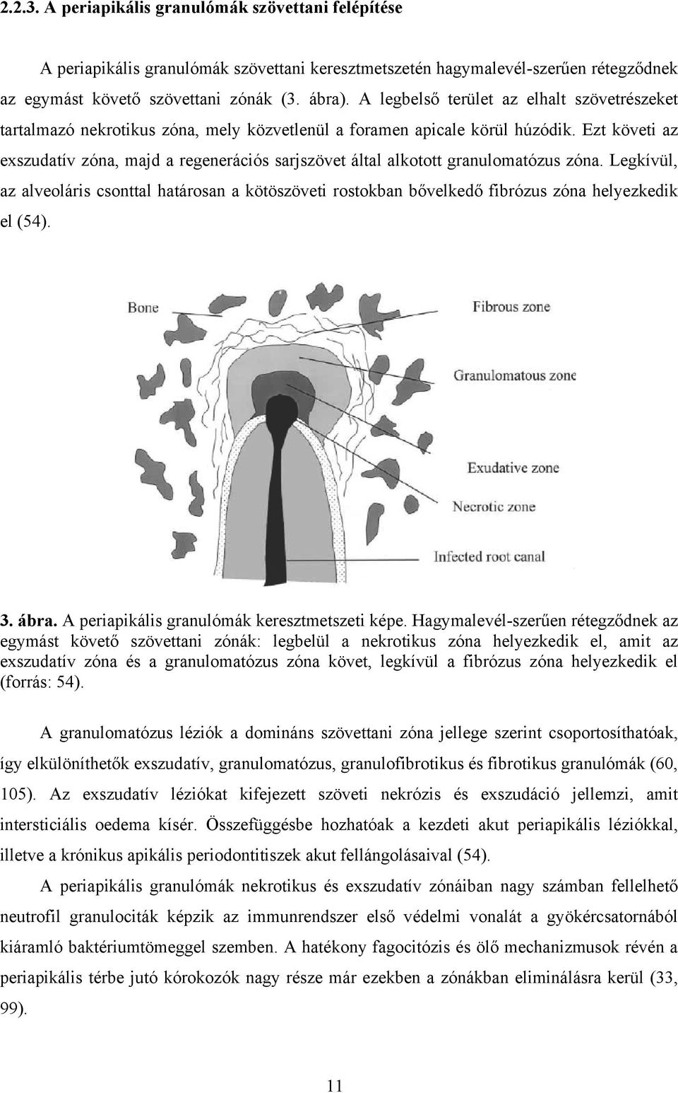 Ezt követi az exszudatív zóna, majd a regenerációs sarjszövet által alkotott granulomatózus zóna.