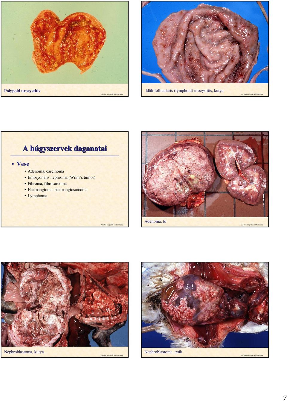 nephroma (Wilm s tumor) Fibroma, fibrosarcoma Haemangioma,