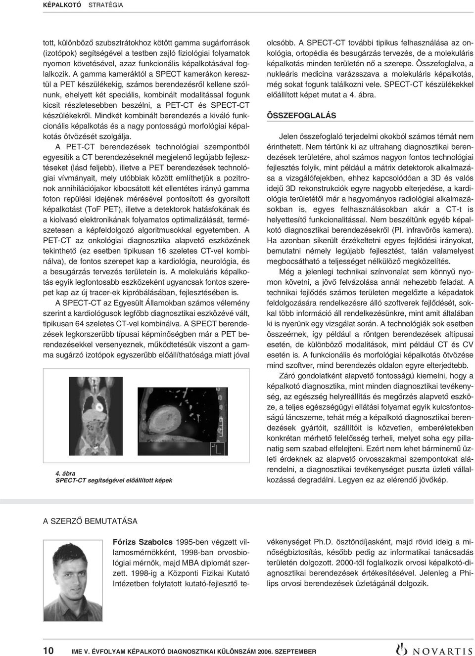 PET-CT és SPECT-CT készülékekrôl. Mindkét kombinált berendezés a kiváló funkcionális képalkotás és a nagy pontosságú morfológiai képalkotás ötvözését szolgálja.