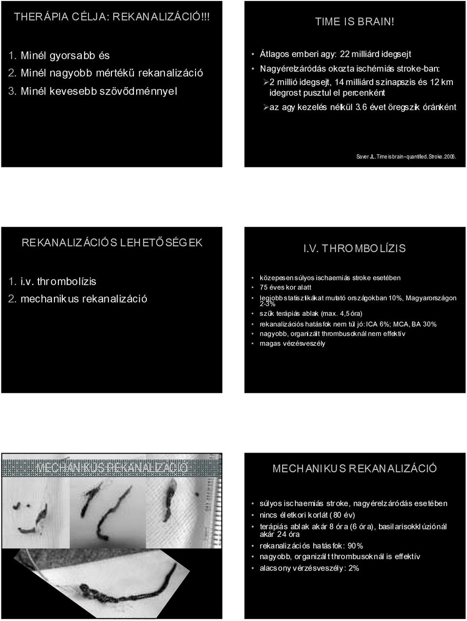 agy kezelés nélkül 3.6 évet öregszik óránként Saver JL. Time is brain--quantified. Stroke. 2006. REKANALIZ ÁCIÓ S LEHETŐ SÉG EK I.V. THRO MBO LÍZIS 1. i.v. thr ombolízis 2.