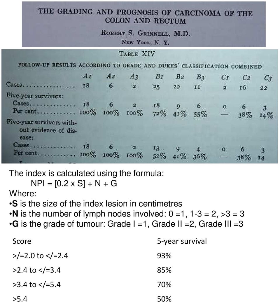 number of lymph nodes involved: 0 =1, 1-3 = 2, >3 = 3 G is the grade of tumour: