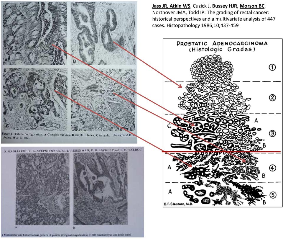 cancer: historical perspectives and a