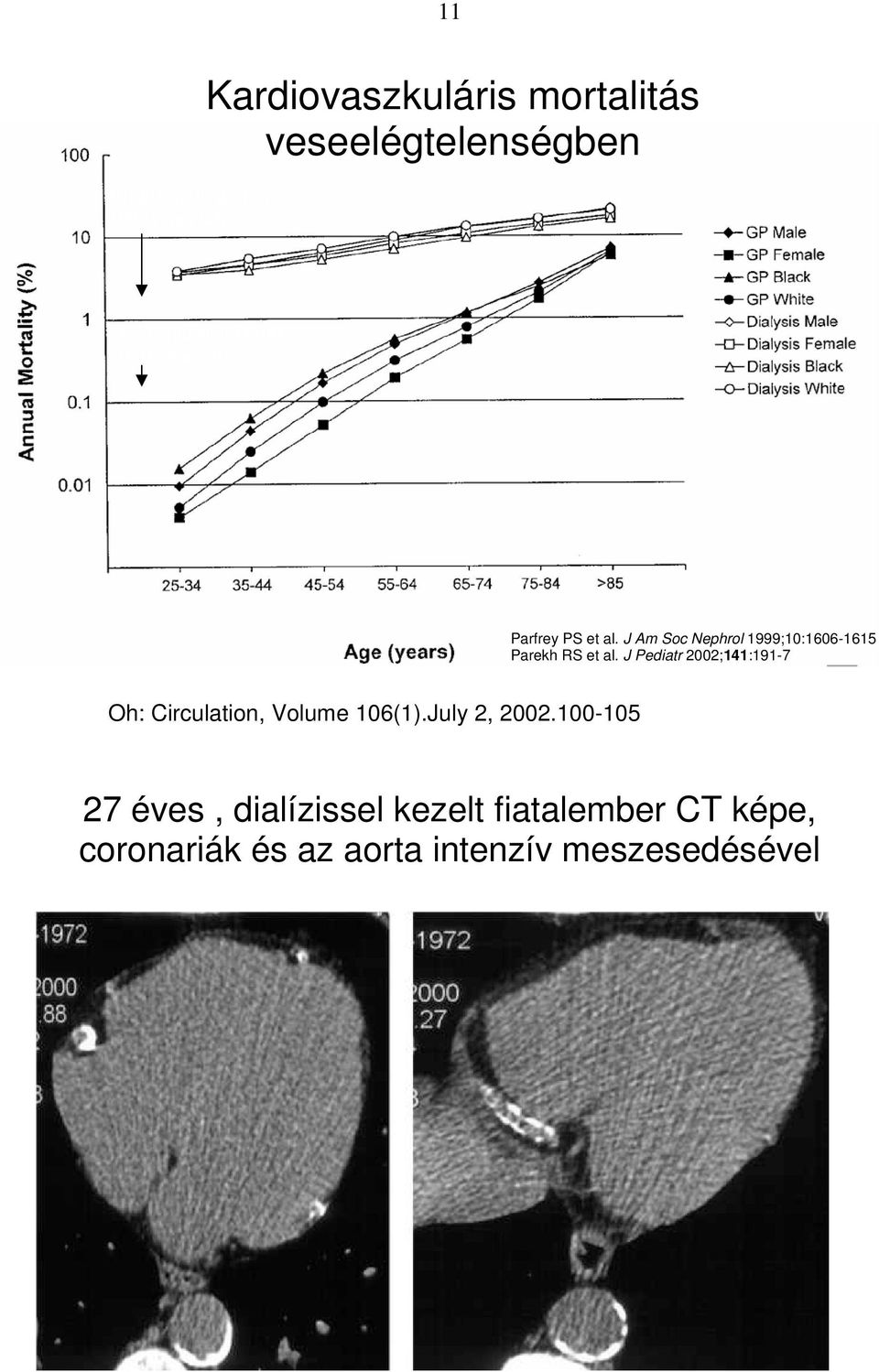 J Am Soc Nephrol 1999;10:1606-1615 Parekh RS et al.