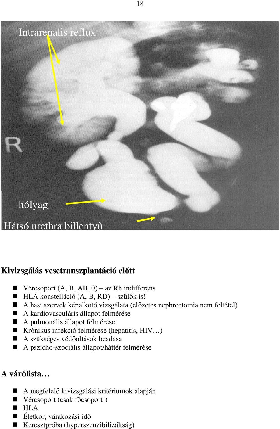 A hasi szervek képalkotó vizsgálata (elızetes nephrectomia nem feltétel) A kardiovasculáris állapot felmérése A pulmonális állapot felmérése