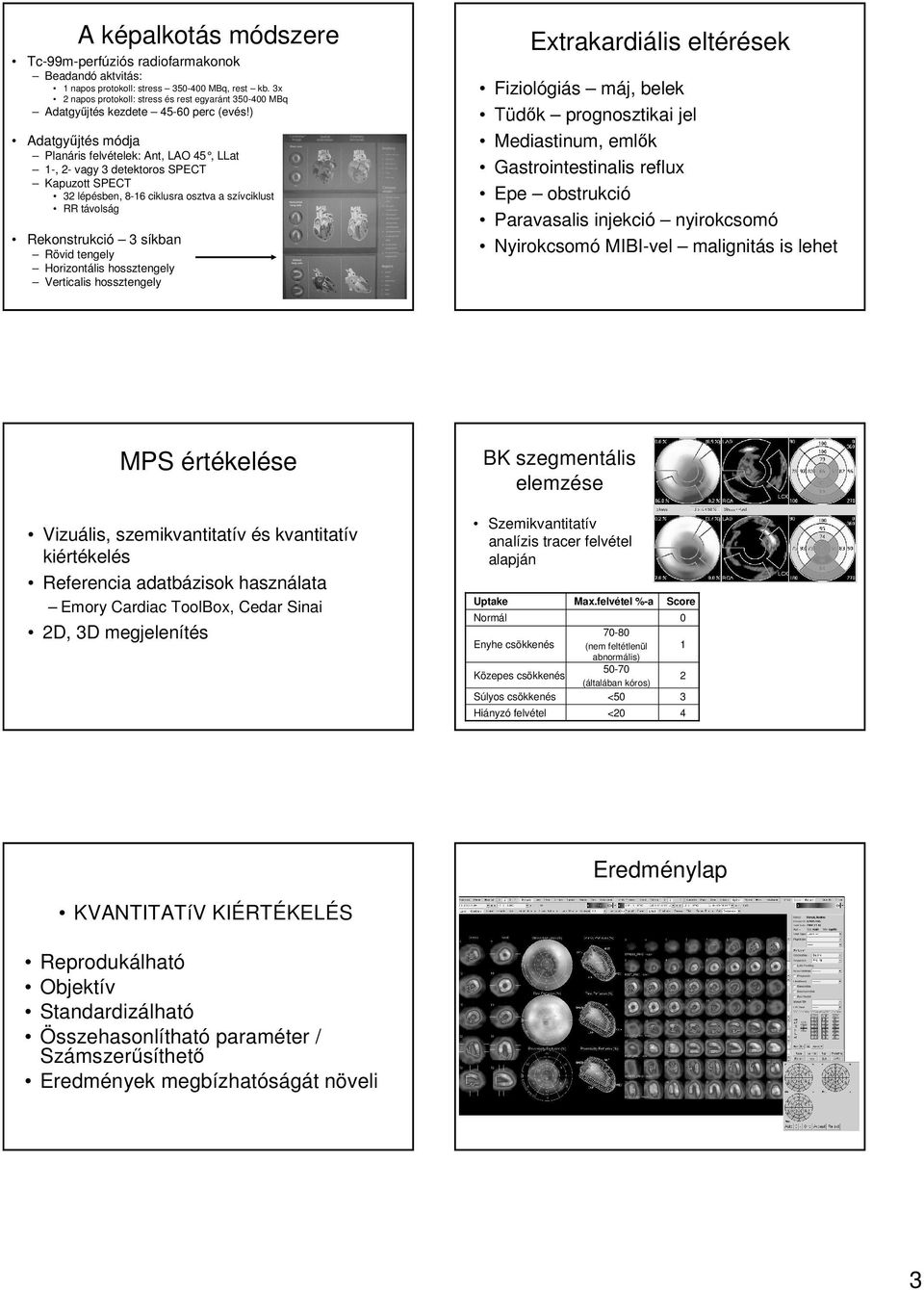 ) Adatgyőjtés módja Planáris felvételek: Ant, LAO 45, LLat 1-, 2- vagy 3 detektoros SPECT Kapuzott SPECT 32 lépésben, 8-16 ciklusra osztva a szívciklust RR távolság Rekonstrukció 3 síkban Rövid