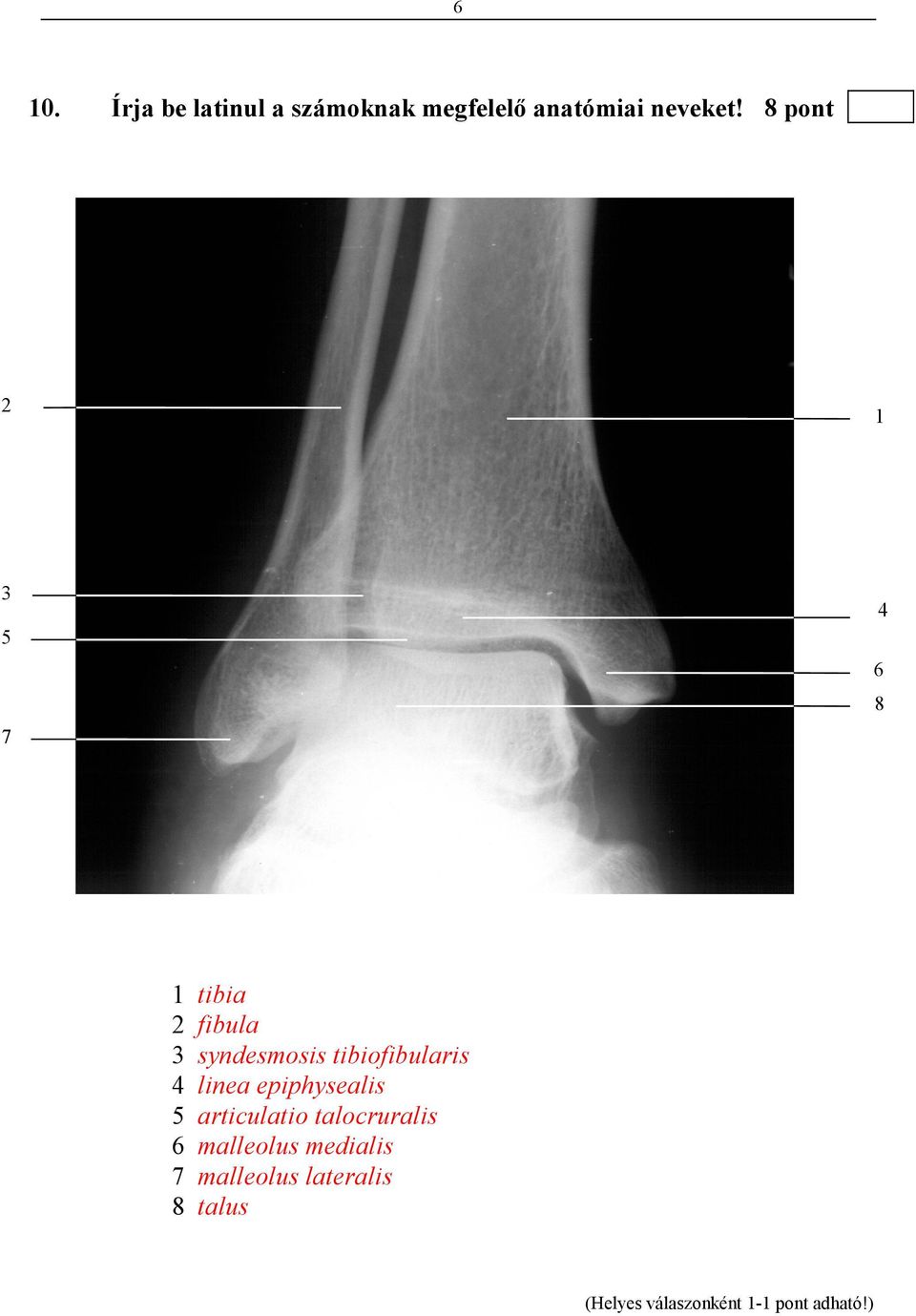 8 pont 2 2 1 1 3 3 5 4 5 6 8 7 7 1 2 3 4 5 6 7 8 tibia