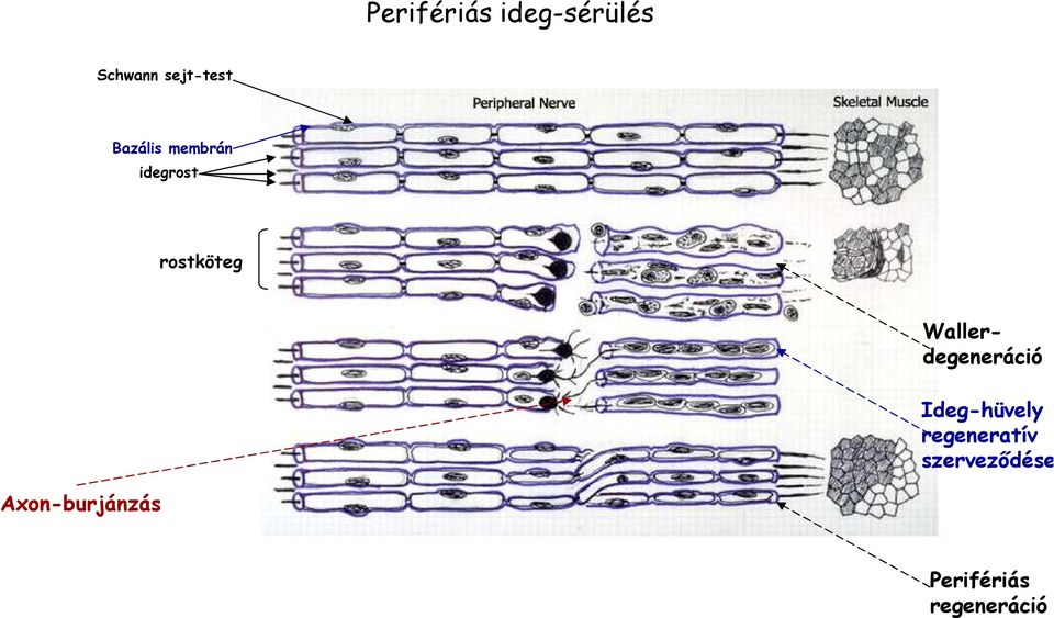 Wallerdegeneráció Ideg-hüvely regeneratív