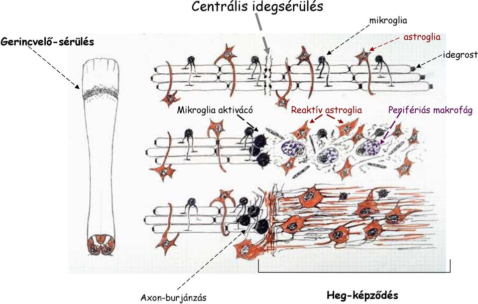 idegrost Mikroglia aktivácó Reaktív