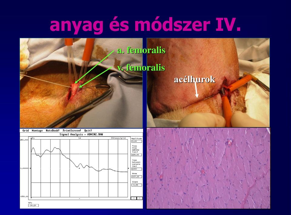 femoralis v.