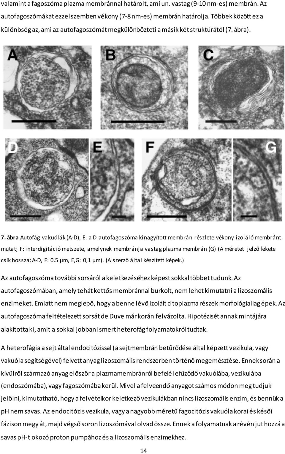 ábra Autofág vakuólák (A-D), E: a D autofagoszóma kinagyított membrán részlete vékony izoláló membránt mutat; F: interdigitáció metszete, amelynek membránja vastag plazma membrán (G) (A méretet jelző