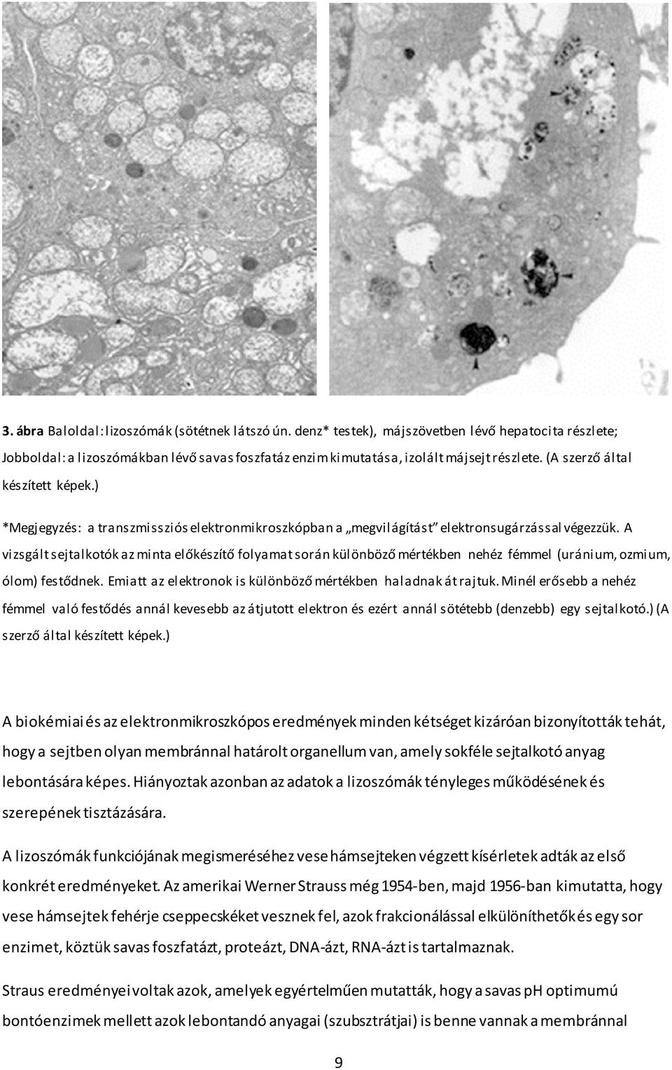 A vizsgált sejtalkotók az minta előkészítő folyamat során különböző mértékben nehéz fémmel (uránium, ozmium, ólom) festődnek. Emiatt az elektronok is különböző mértékben haladnak át rajtuk.