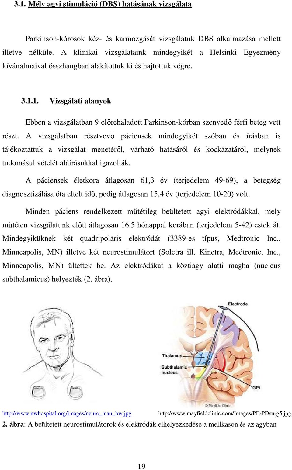 1. Vizsgálati alanyok Ebben a vizsgálatban 9 elırehaladott Parkinson-kórban szenvedı férfi beteg vett részt.