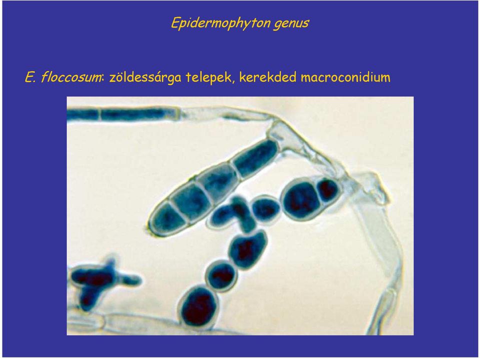 floccosum: