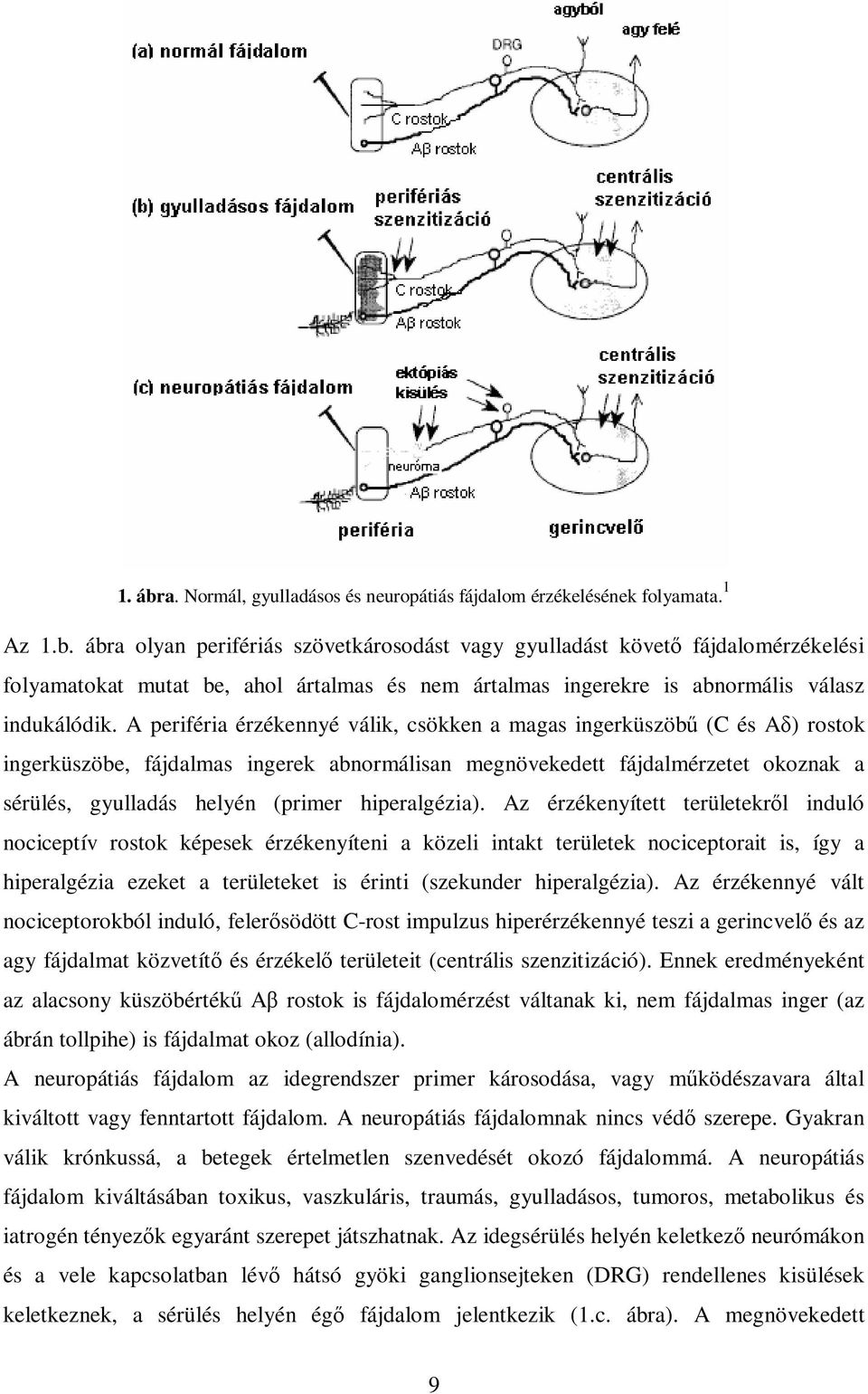 hiperalgézia).