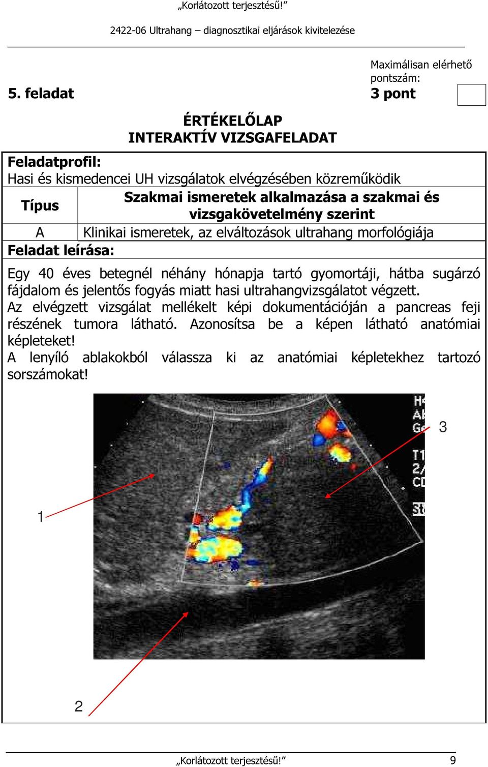 Típus vizsgakövetelmény szerint A Klinikai ismeretek, az elváltozások ultrahang morfológiája Feladat leírása: Egy 40 éves betegnél néhány hónapja tartó gyomortáji, hátba