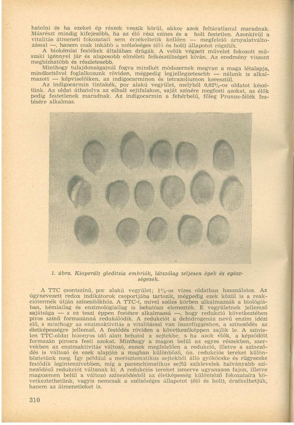 A biokémiai festékek általában drágák. A velük végzett művelet fokozott műszaki igénnyel jár és alaposobb elméleti felkészültséget kíván. Az eredmény viszont megbízhatóbb és részletesebb.