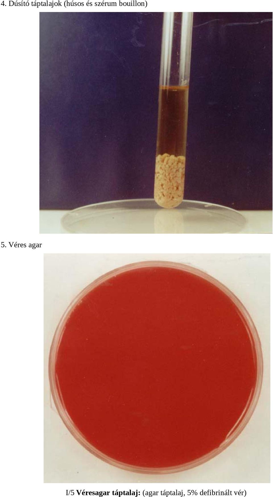 Véres agar I/5 Véresagar