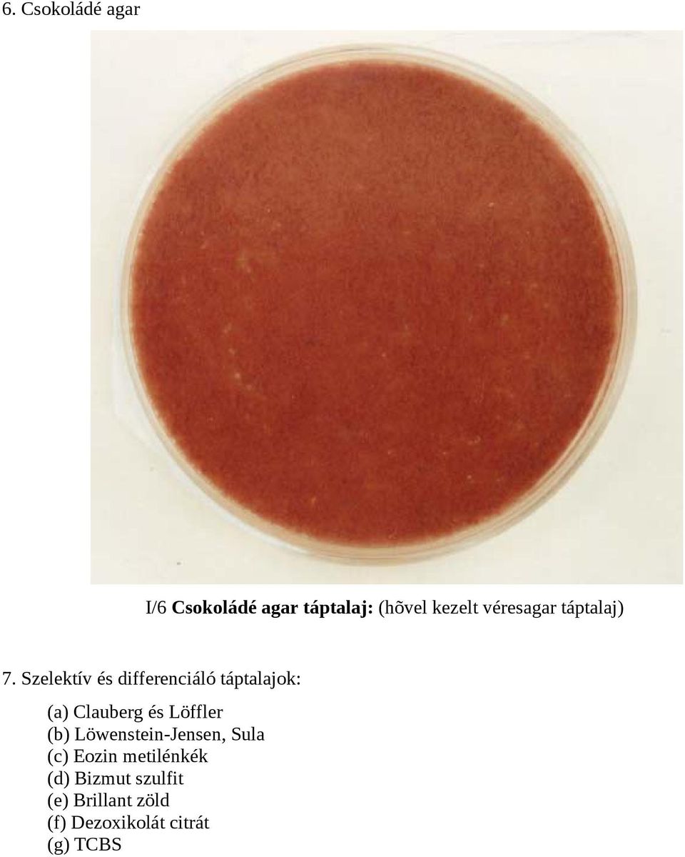 Szelektív és differenciáló táptalajok: (a) Clauberg és Löffler