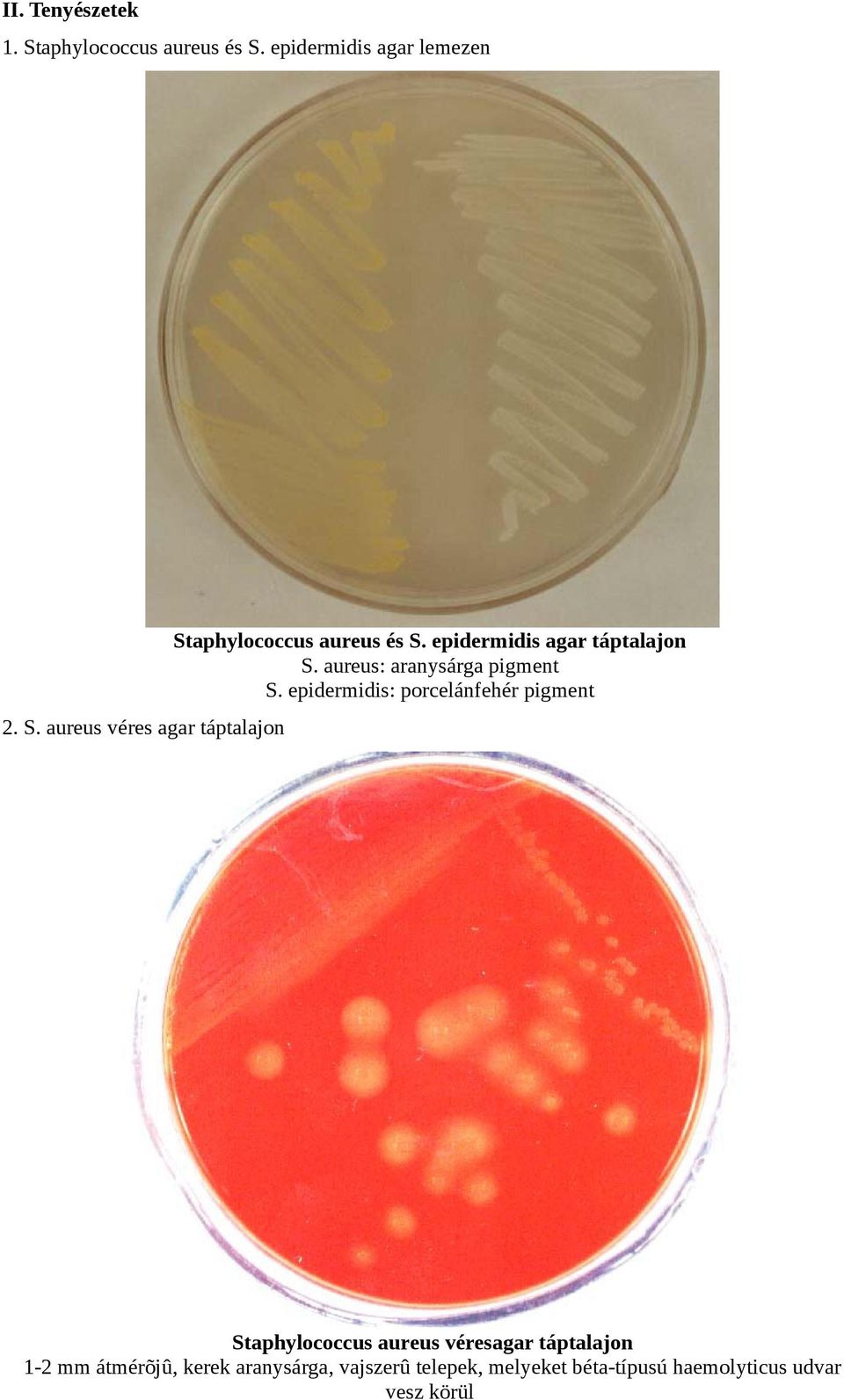 aureus: aranysárga pigment S.