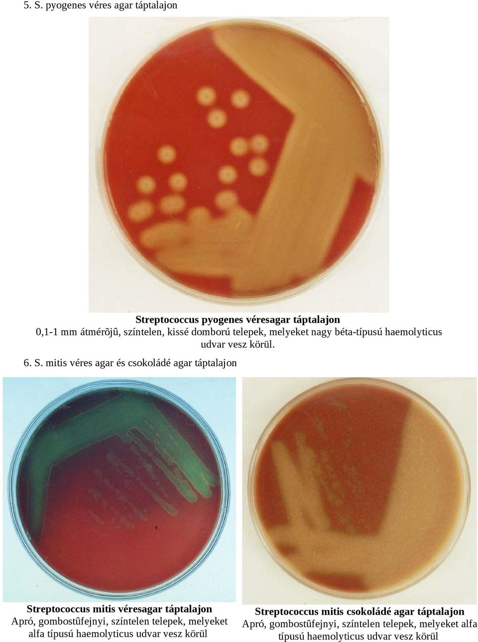 mitis véres agar és csokoládé agar táptalajon Streptococcus mitis véresagar táptalajon Apró, gombostûfejnyi, színtelen telepek,