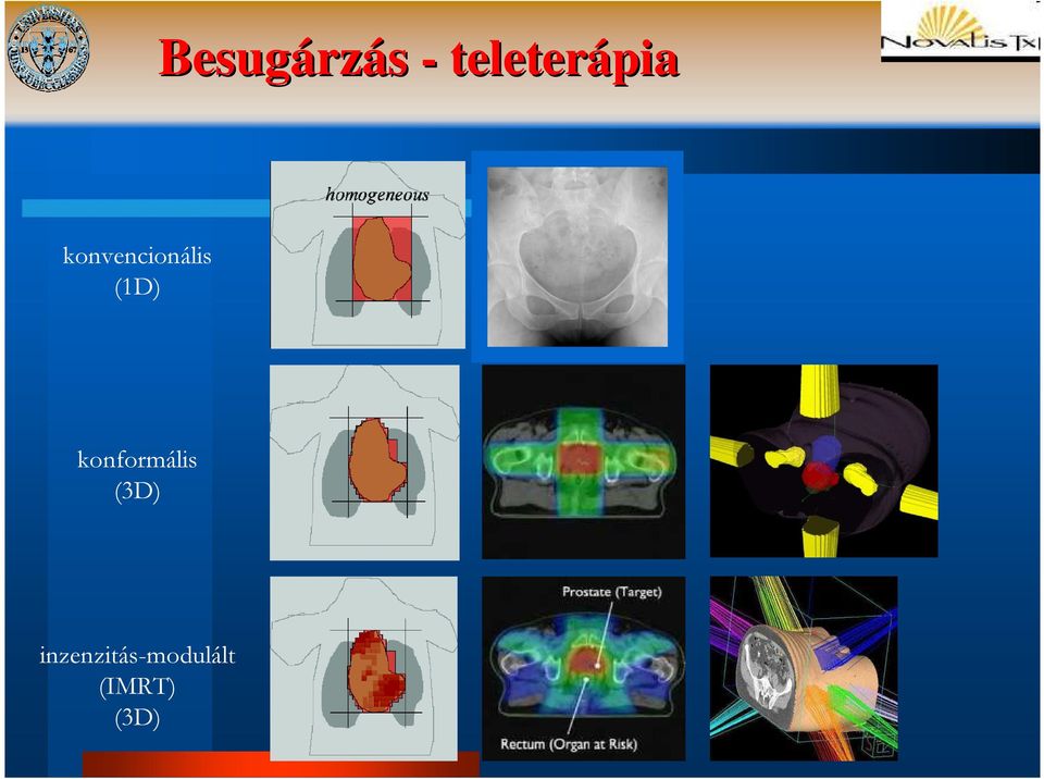 konvencionális (1D)