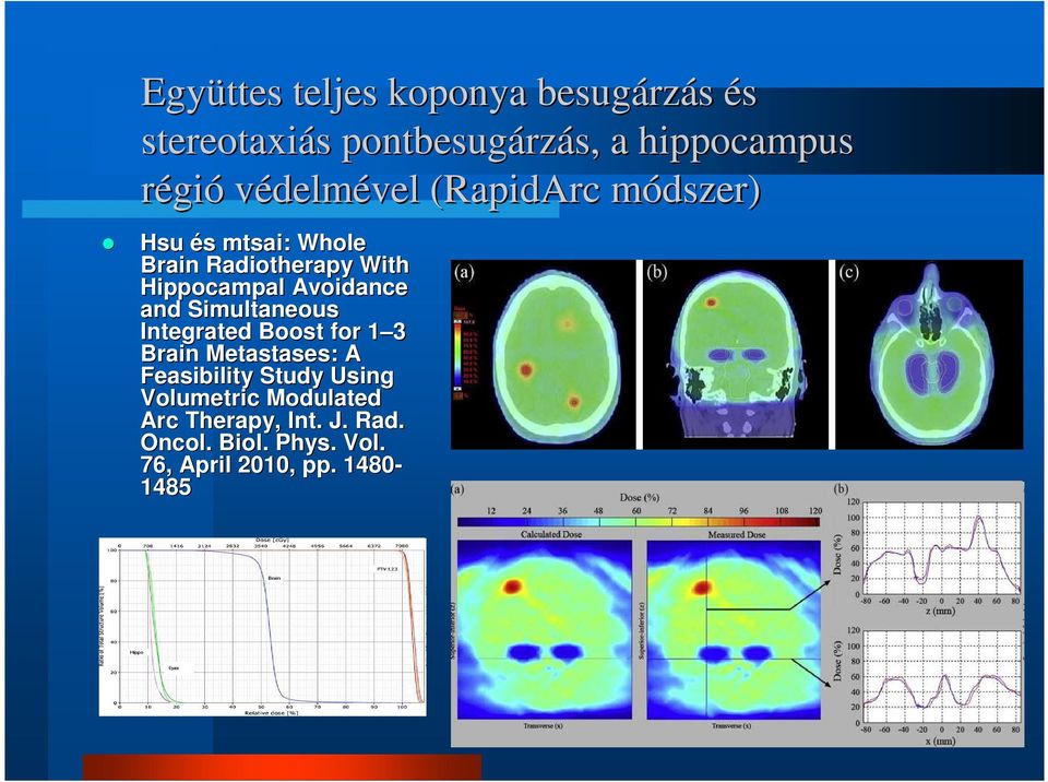 Avoidance and Simultaneous Integrated Boost for 1 3 Brain Metastases: : A Feasibility Study