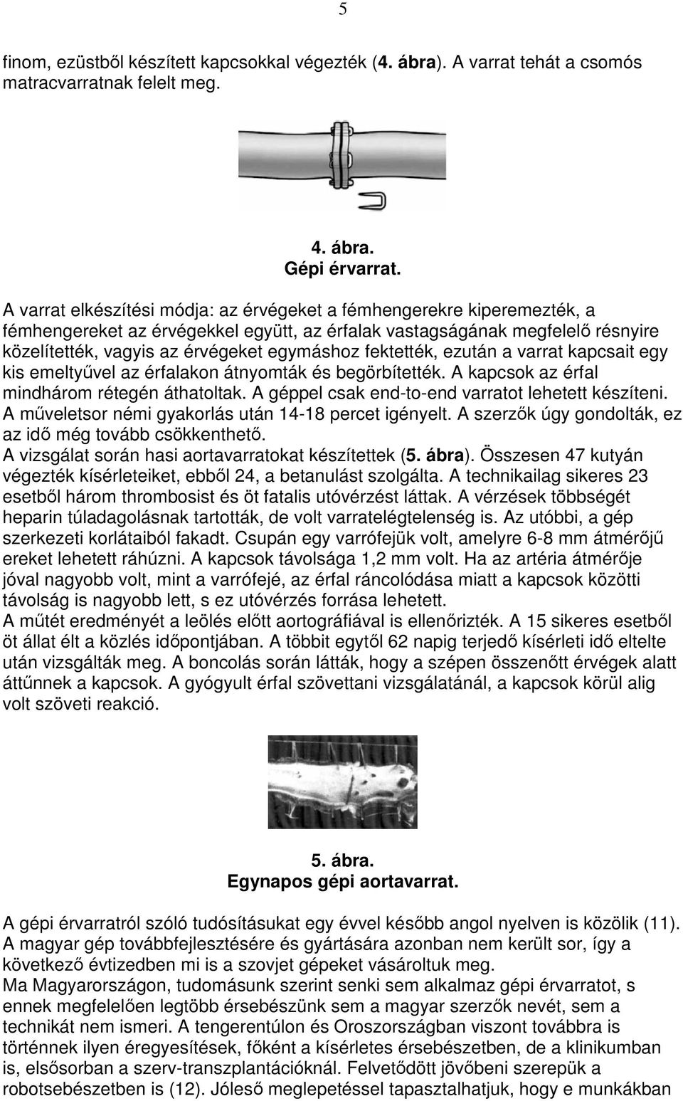 fektették, ezután a varrat kapcsait egy kis emeltyővel az érfalakon átnyomták és begörbítették. A kapcsok az érfal mindhárom rétegén áthatoltak. A géppel csak end-to-end varratot lehetett készíteni.