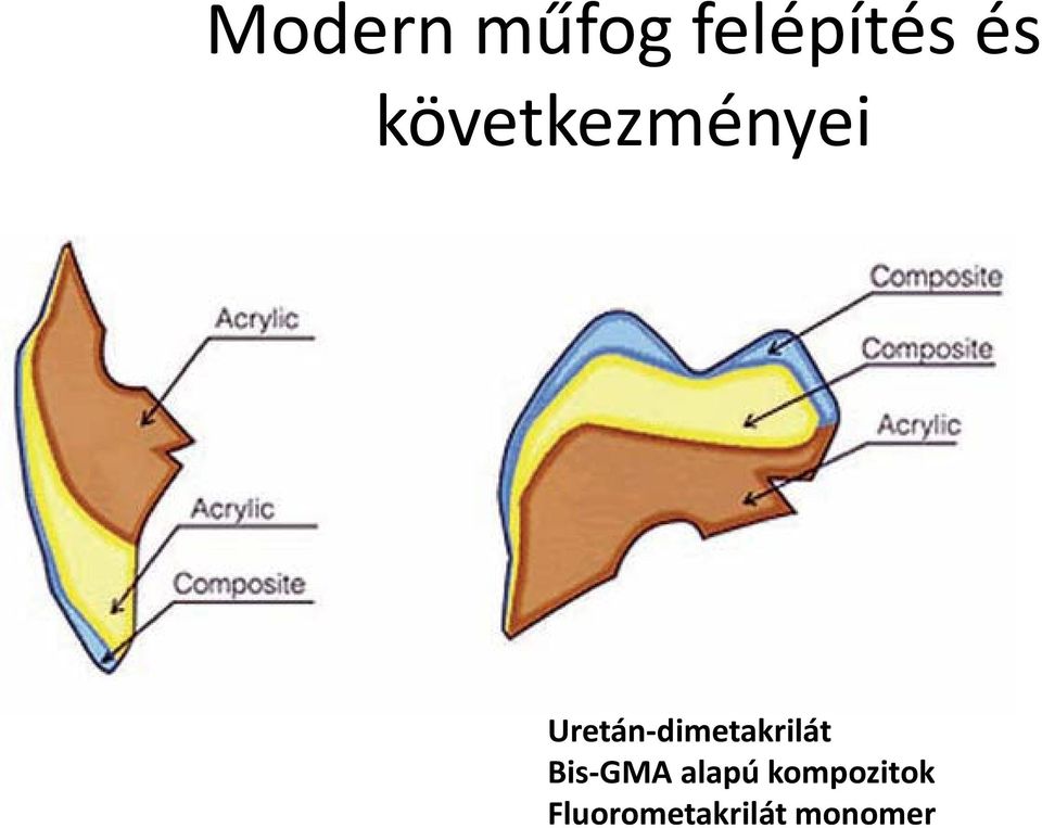 Uretán-dimetakrilát Bis-GMA