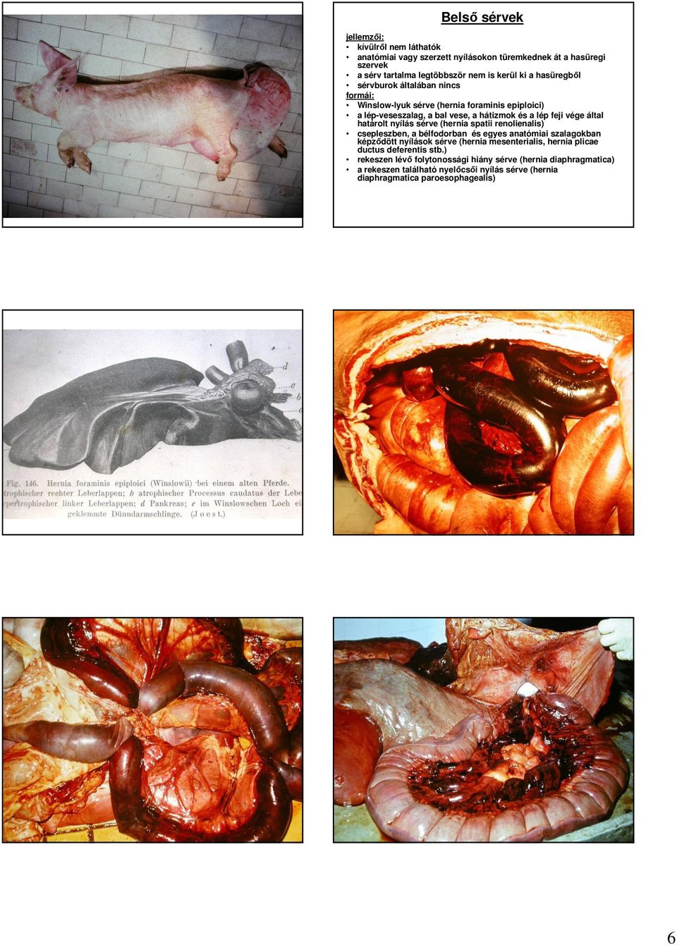 határolt nyílás sérve (hernia spatii renolienalis) csepleszben, a bélfodorban és egyes anatómiai szalagokban képzıdött nyílások sérve (hernia mesenterialis, hernia