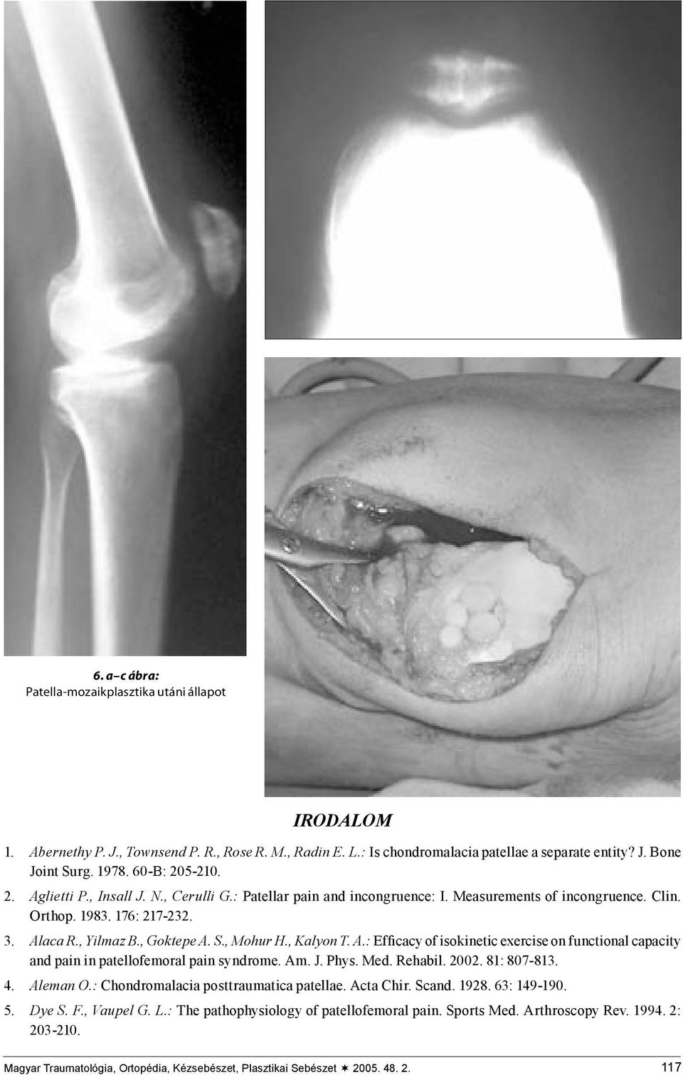 , Mohur H., Kalyon T. A.: Efficacy of isokinetic exercise on functional capacity and pain in patellofemoral pain syndrome. Am. J. Phys. Med. Rehabil. 2002. 81: 807-813. 4. Aleman O.