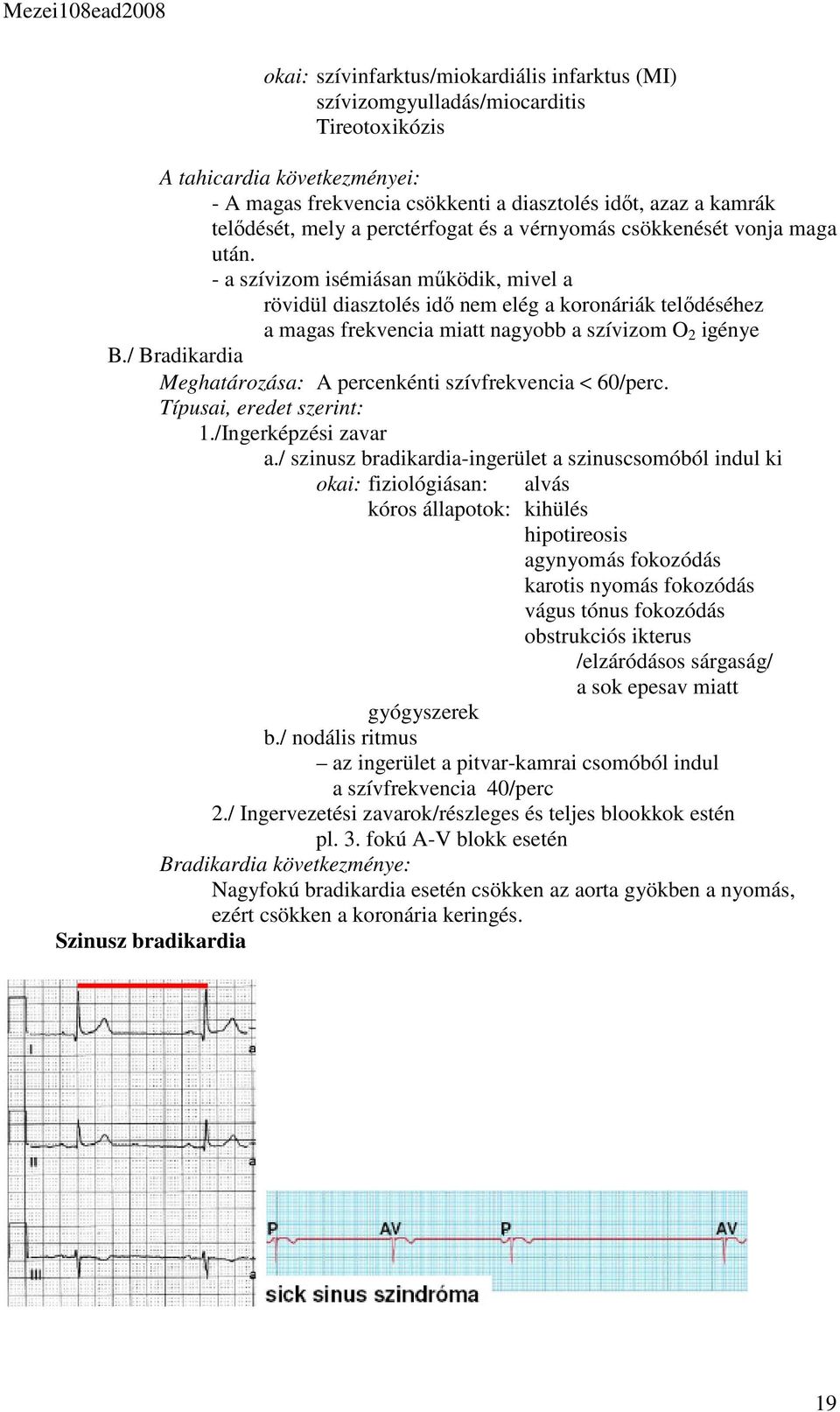 - a szívizom isémiásan működik, mivel a rövidül diasztolés idő nem elég a koronáriák telődéséhez a magas frekvencia miatt nagyobb a szívizom O 2 igénye B.