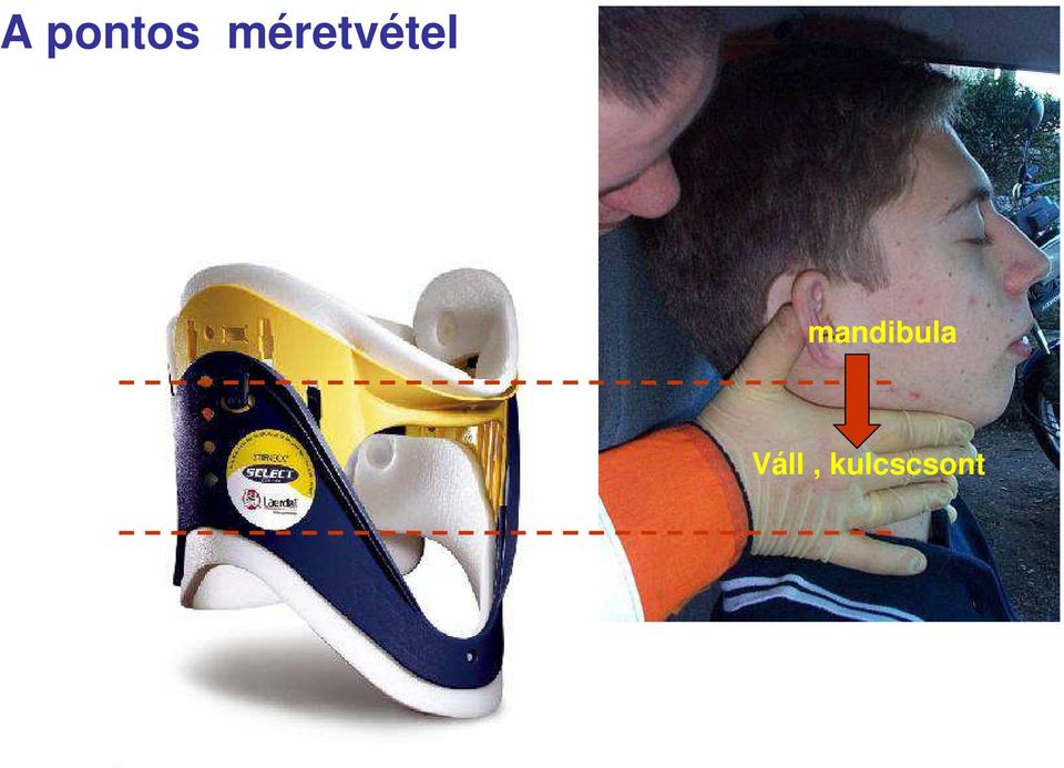 mandibula