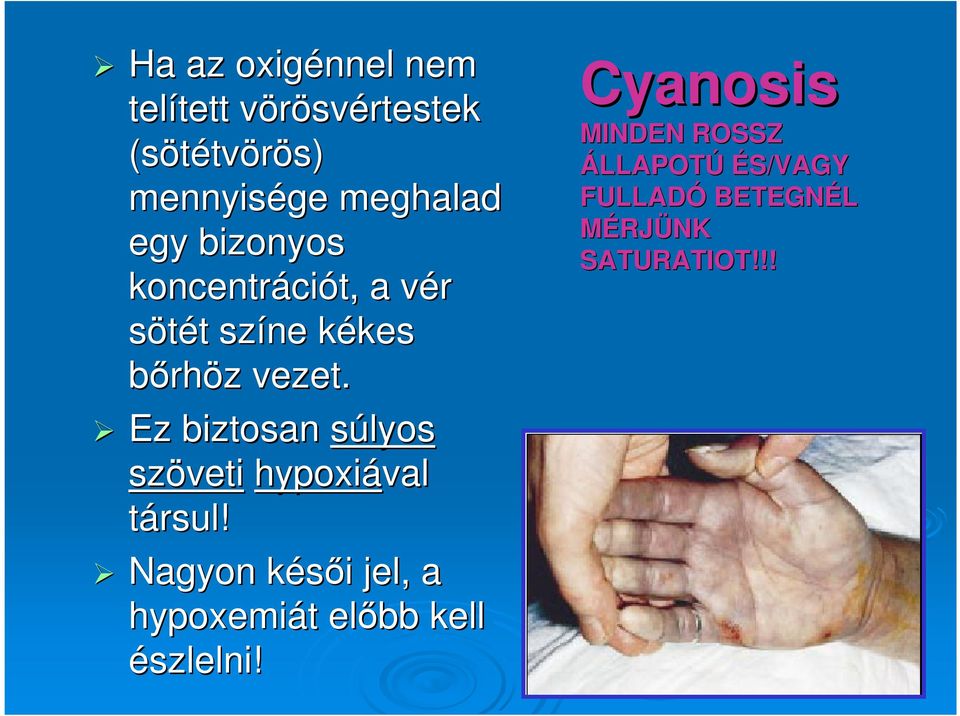 Ez biztosan súlyos szöveti hypoxiával társul!