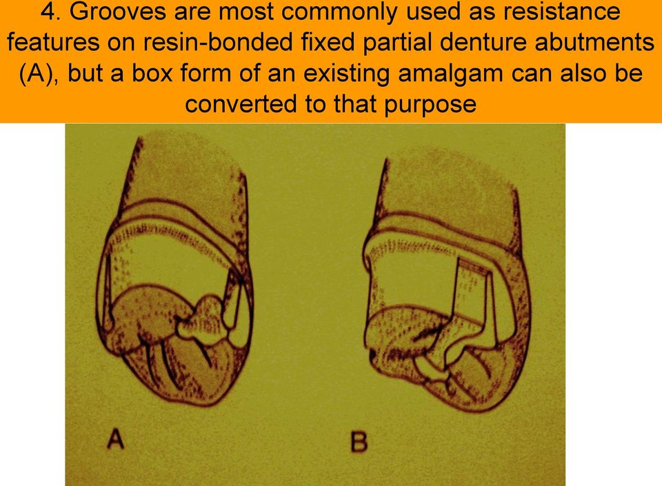 partial denture abutments (A), but a box form