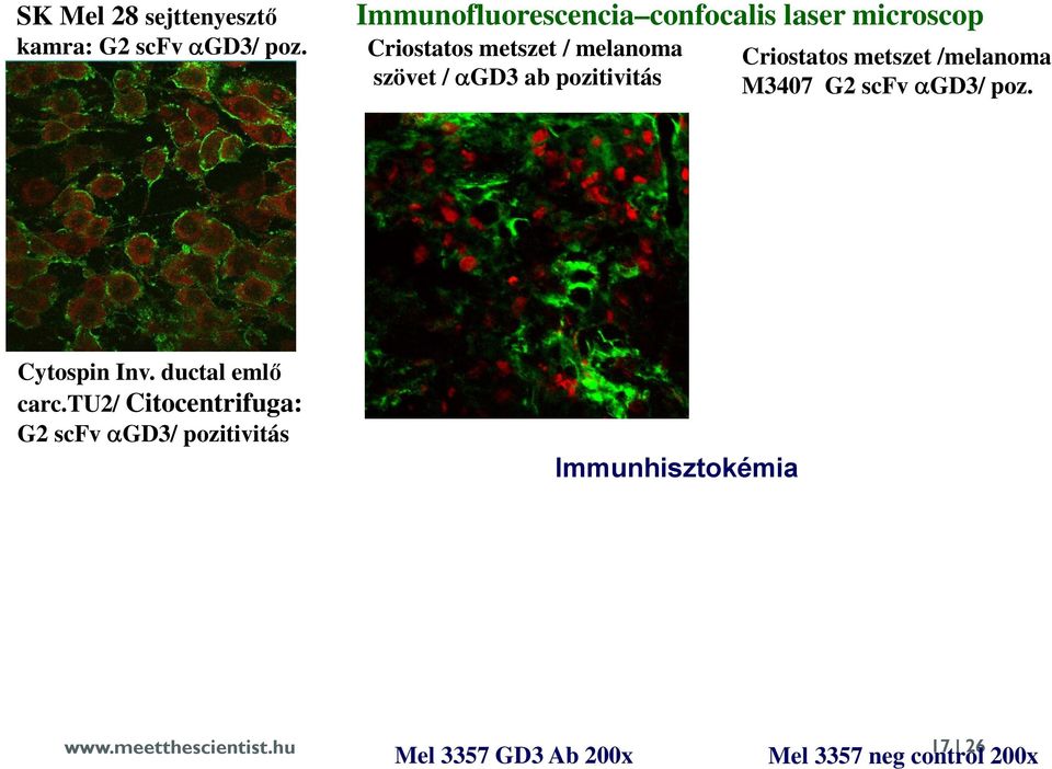 pozitivitás Criostatos metszet /melanoma M3407 G2 scfv GD3/ poz. Cytospin Inv.