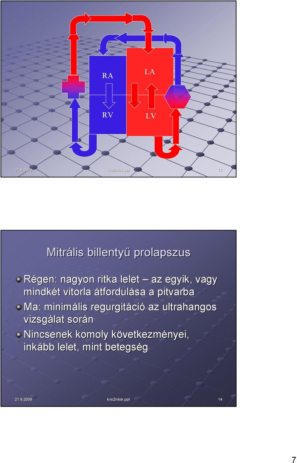 pitvarba Ma: minimális regurgitáció az ultrahangos vizsgálat