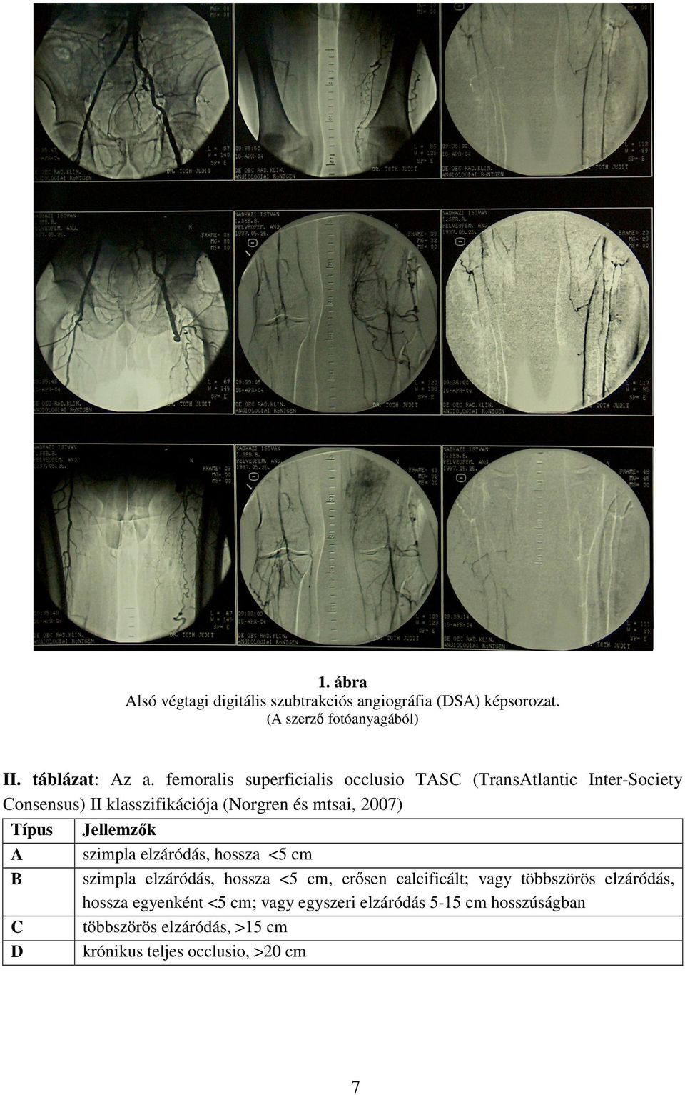 Típus Jellemzők szimpla elzáródás, hossza <5 cm A szimpla elzáródás, hossza <5 cm, erősen calcificált; vagy többszörös