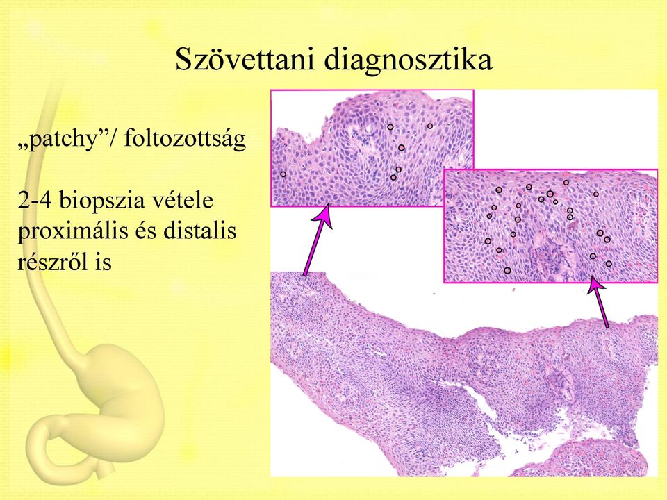 2-4 biopszia vétele