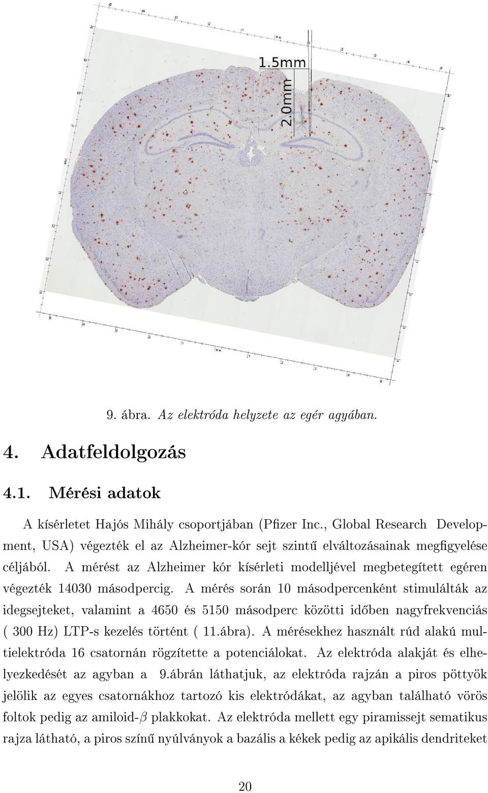 A mérést az Alzheimer kór kísérleti modelljével megbetegített egéren végezték 14030 másodpercig.