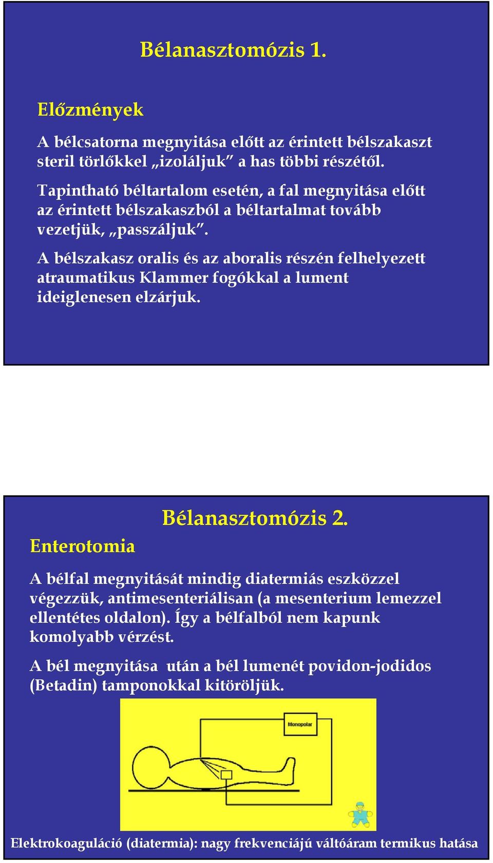 A bélszakasz oralis és az aboralis részén felhelyezett atraumatikus Klammer fogókkal a lument ideiglenesen elzárjuk. Enterotomia Bélanasztomózis 2.