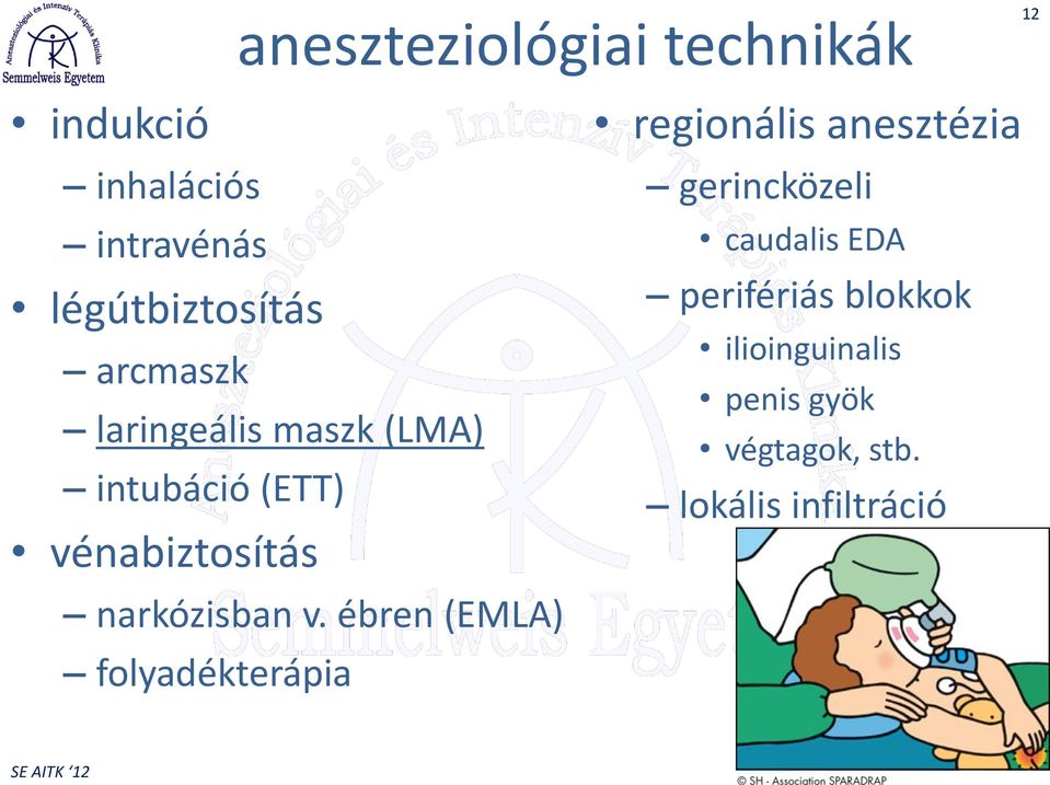 ébren (EMLA) folyadékterápia regionális anesztézia gerincközeli caudalis EDA