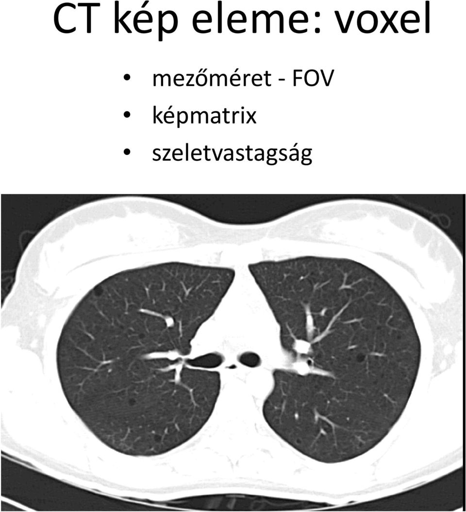 - FOV képmatrix