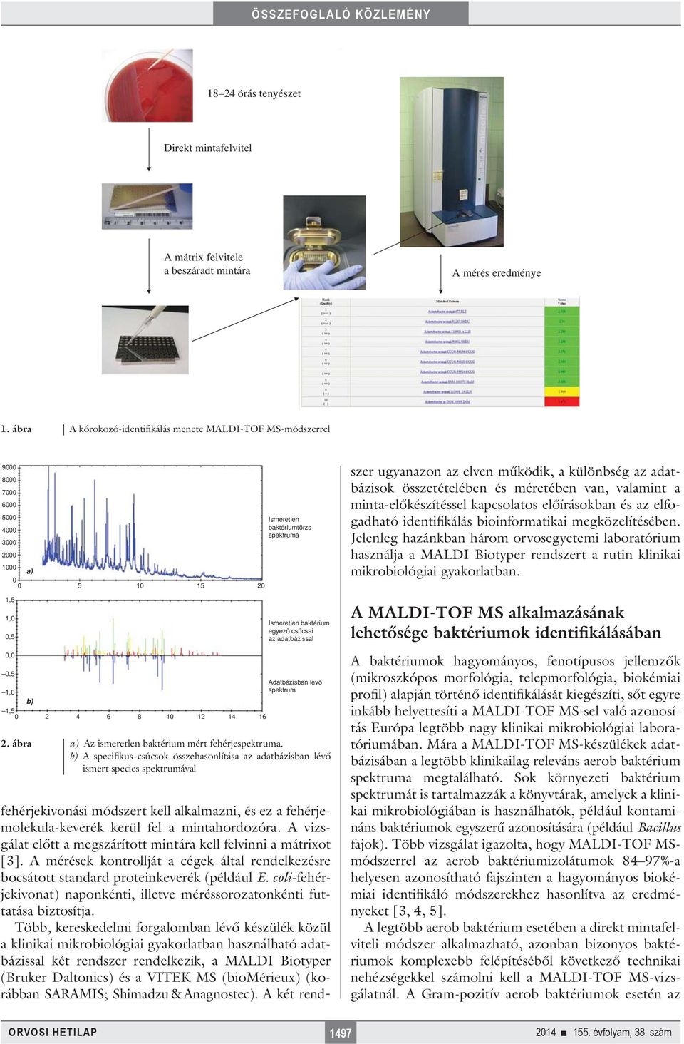adatbázissal 0,5 1,0 spektrum b) 1,5 0 2 4 6 8 10 12 14 16 2. ábra a) Az ismeretlen baktérium mért fehérjespektruma.